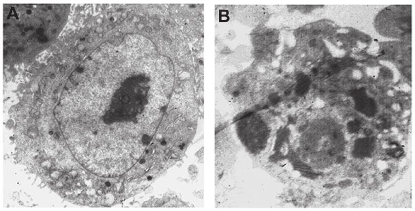 2132 PENG et al: BAICALEIN INDUCES APOPTOSIS OF HUMAN CERVICAL CANCER HeLa CELLS Figure 3.