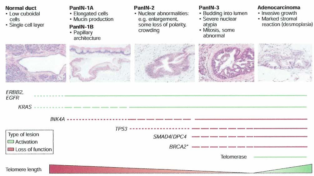 Pancreatic Oncogenesis Bardeesy and
