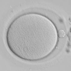 Research on human embryos at the VUB Day 0 Day 1 Day 1,5 Day 2 Day 3 Day 4 Day 5 Totipotency and differentiation (De Paepe and Krivega et al. 2014) Cell cycle features (Krivega et al.