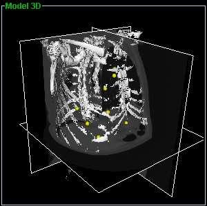 2 VISUALIZATION OF IMAGES The entire visualization of CAT scan stack images and 3D model creation is performed using the Visual Toolkit (VTK - www.vtk.org) (Schroeder et al., 1998).