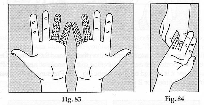 Massaging and giving pressure on the ring and the little finger of both the hands is very helpful in curing ear ailments (fig. 83). The method of giving pressure at these areas is given in fig. 84.
