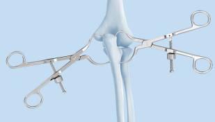 Instruments Periarticular Reduction Forceps: to