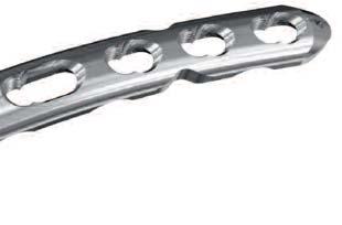 Implant features Tapered plate tip Tapered end for submuscular plate insertion