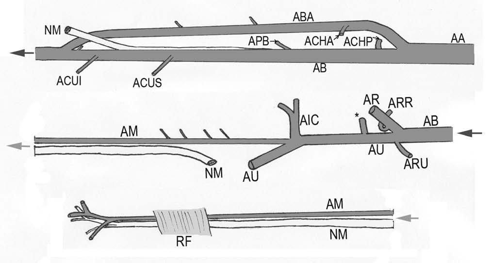 A CASE OF A DOUBLE VARIANT OF THE ARTERIAL SYSTEM IN THE UPPER EXTREMITY 645 Fig. 3 Schema of the double variant of arterial system in the upper extremity. Bar 1 cm.