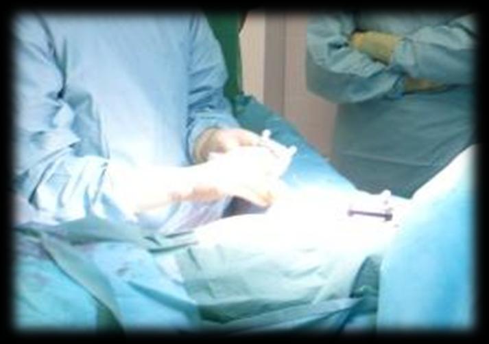 Freehand SPECT imaging technology used in CSS300 during surgery Data with tracked non-imaging
