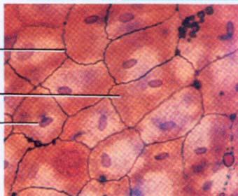 Mesothelial Lining of Peritoneal Cavity Plasma membrane cytoplasm nucleus 10 The lining of the peritoneal cavity (roughly the abdominal cavity) is formed of a