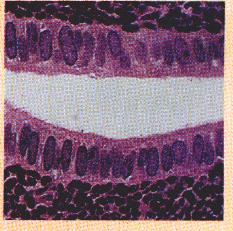Simple Columnar Epithelium basement membrane Tubule lumen nucleus 15 This is a longitudinal section of a kidney tubule in which the simple columnar epithelial cells are