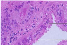Ciliated Simple Columnar of Fallopian Tube nucleus cilia lumen Ciliated simple