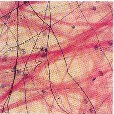 Areolar Tissue Elastic fibers Mast cell Collagen fibers Found in in outer dermis of skin, interstitial tissue, mesenteries and serous membranes.