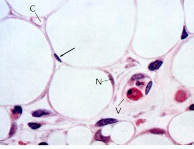 Adipose Tissue high power capillary nucleus of adipocyte venule nucleus of adjacent fibroblast 33 Adipose tissue is found in large amounts