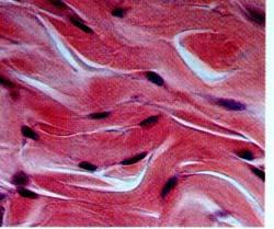 High power Dense Irregular Connective Tissue Low power Nuclei of fibroblasts Collagen fibers Found in in the