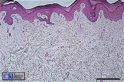 34 Dense regular is also known as fibrous connective tissue, or inelastic tissue.