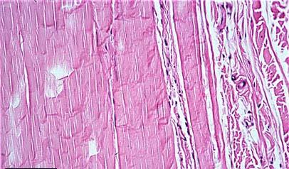 Dense Regular (Fibrous Connective Tissue) Found in in tendons, ligaments, and fascial coverings. Tendon, l.s. collagen fibers nuclei of fibroblasts 35 Dense regular tissue is found where tensile strength is important, such as tendons and ligaments.