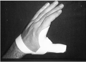 Stretch opposing muscles to prevent contracture FDS stretch with