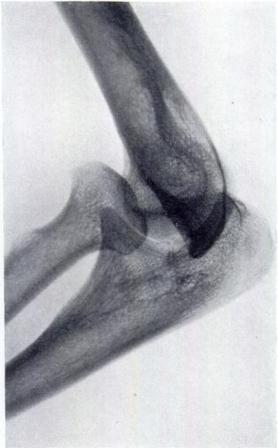 years). Figure 10- Roberta s left hand.