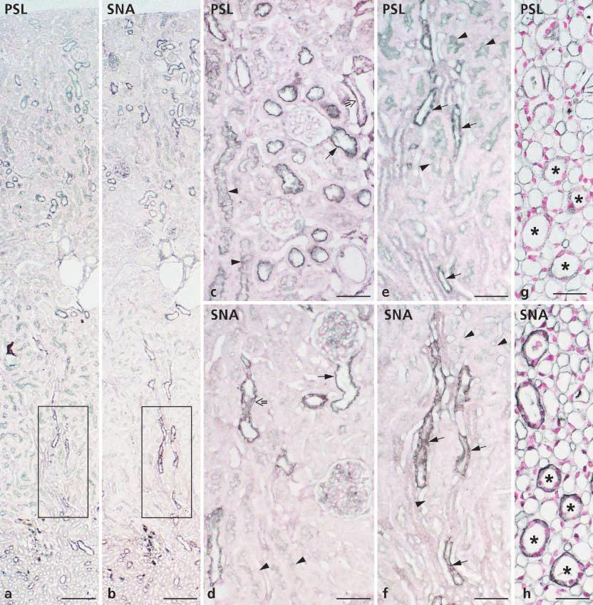 189 Fig. 6a h Rat kidney. At low magnification, the differences in staining pattern by PSL (a) and SNA (b) in cortex and part of outer medulla are visible.