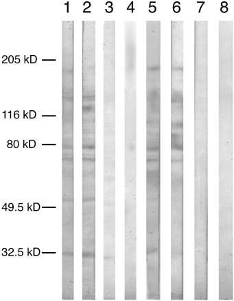 Fig. 8 Lectin blots of electrophoretically resolved protein homogenates from rat liver (lanes 1 4) and kidney (lanes 5 8).