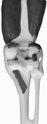The Knee 6. A majority of humans experience disorders associated with the knee joint at some time in their lives. This is in part due to the degree of impact on the joint through frequent use.