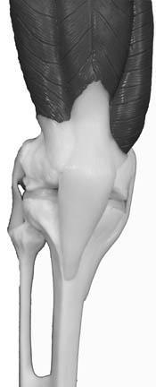 In addition to tendons and ligaments, the knee joint has cartilage connective tissue. The meniscus is made of one type of cartilage, called. Find the meniscus in the model.
