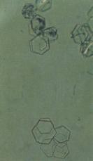 but only thick cystine crystals polarize Solubility Dissolves in HCl, NaOH & Ammonium hydroxide Insoluble: acetic