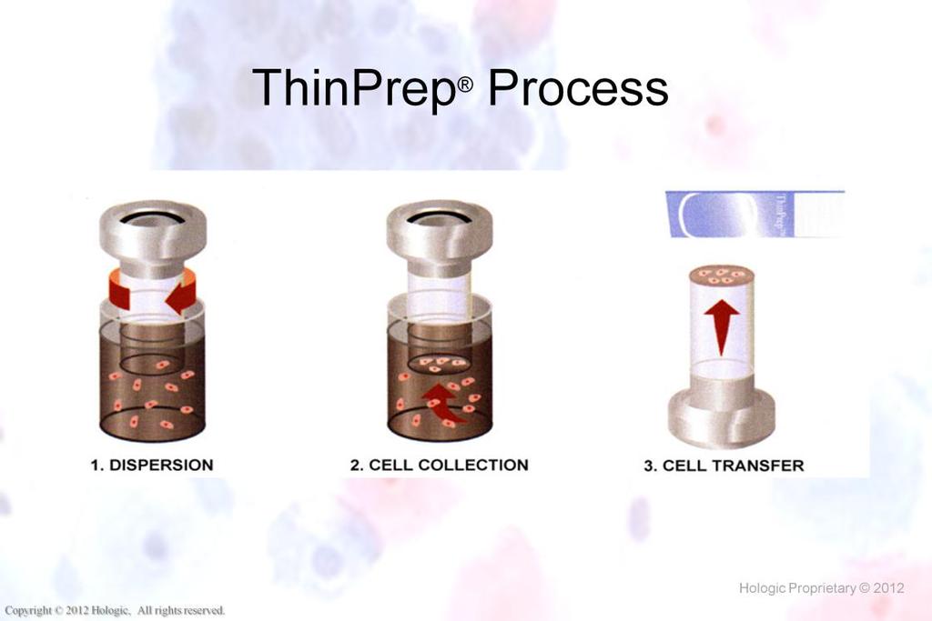 Morphology I Slide: 4 ThinPrep Process Three key phases 1. Dispersion: Randomizes/homogenizes patient s cell population within the vial. 2.