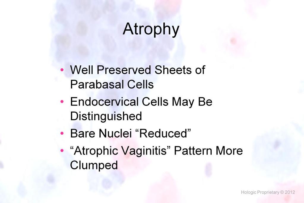 Morphology I Slide: 46 Atrophy Preservation is greatly enhanced as a result of the liquid based fixation with the elimination of the air-drying artifact commonly seen on CP.