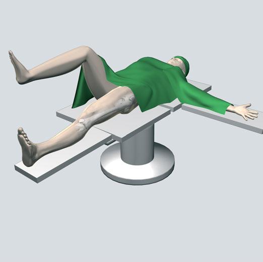 ANTEGRADE APPROACH OPENING THE PROXIMAL FEMUR 1 Position patient Place the patient in a supine position or lateral decubitus position (not shown) on a fracture or radiolucent table.