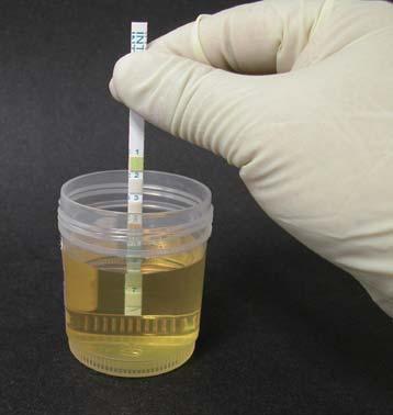 Test strips for detecting adulterants In order to interfere with a drug test, someone may add adulterants into the urine specimen leading to the inability to run the test (an invalid test) or a false