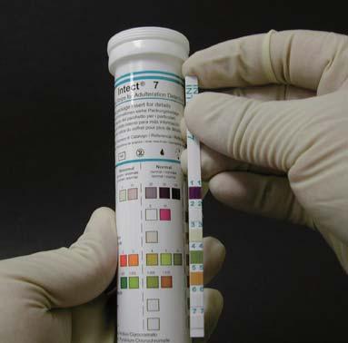 Each test strip contains 6 to 7 chemical-treated reagent pads that will change colour upon dipping the testing strip into the specimen.