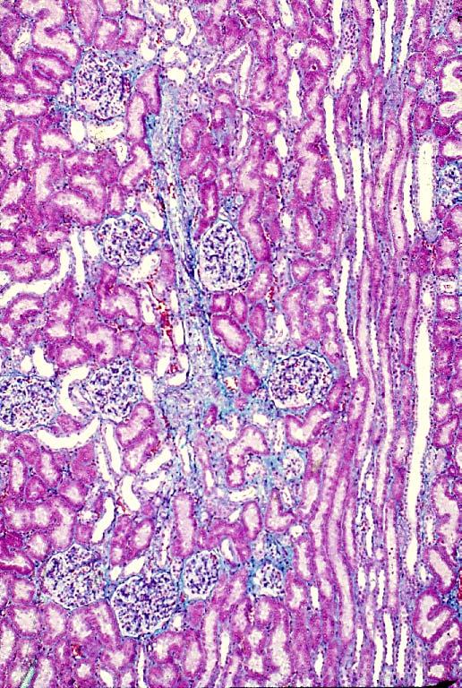Labyrinth Medullary ray Renal corpuscle Arteria radiata 15-09.