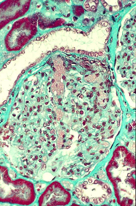 Macula densa P 15-20. Renal corpuscle 8.