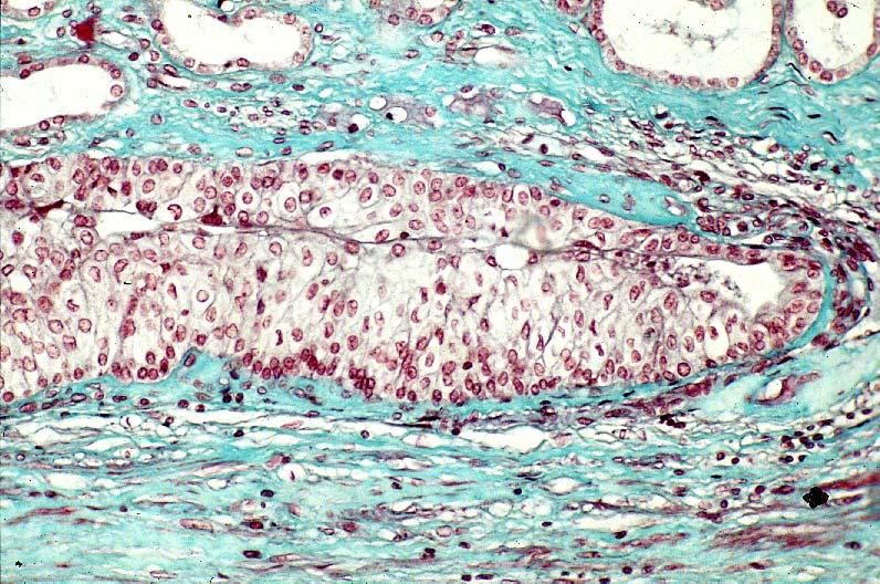 15-40. Apex of renal papilla.