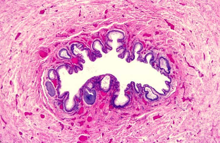 15-47. Female urethra.