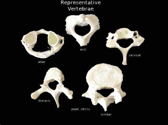 Examples of Vertebrae What can you palpate? What can you NOT palpate?
