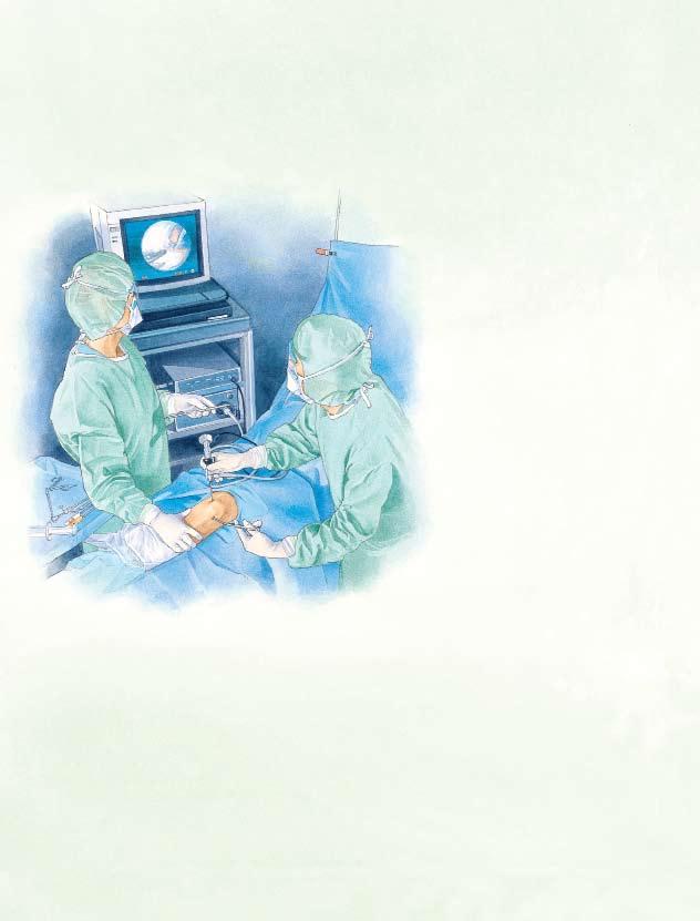 How Arthroscopy Works To look inside your ankle, your surgeon will use an arthroscope.