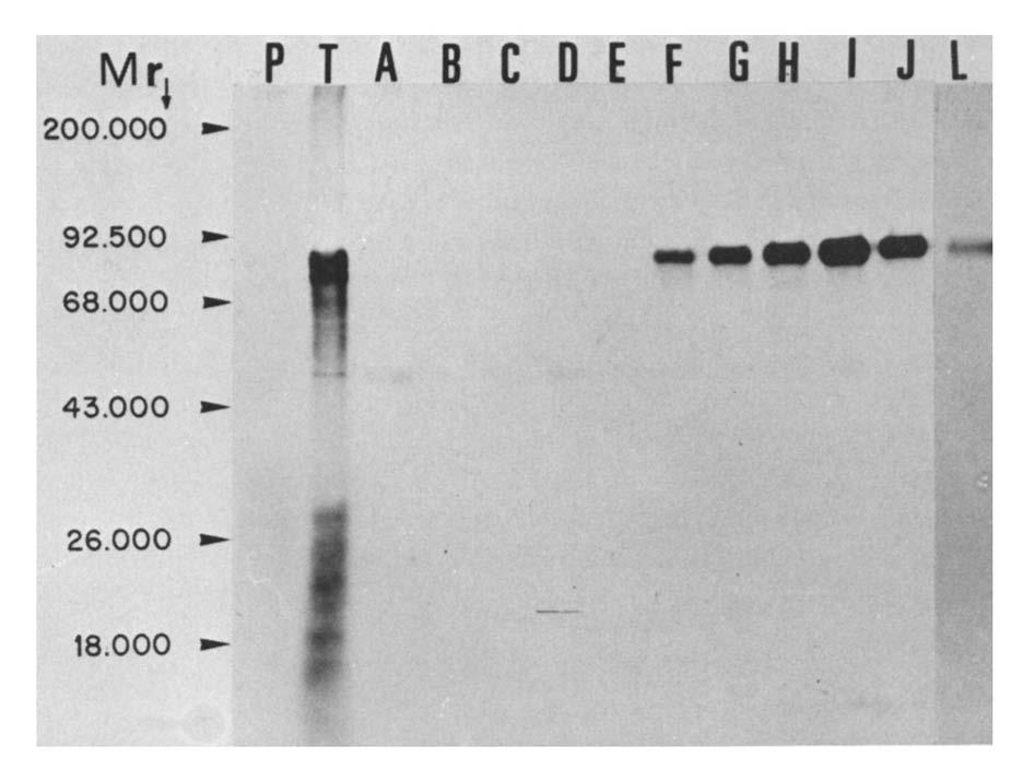 322 Fig. 3. PAGE of the proteins immunoprecipitated with the trypomastigote stage specific antiserum from cells incubated in TAUP for different times.
