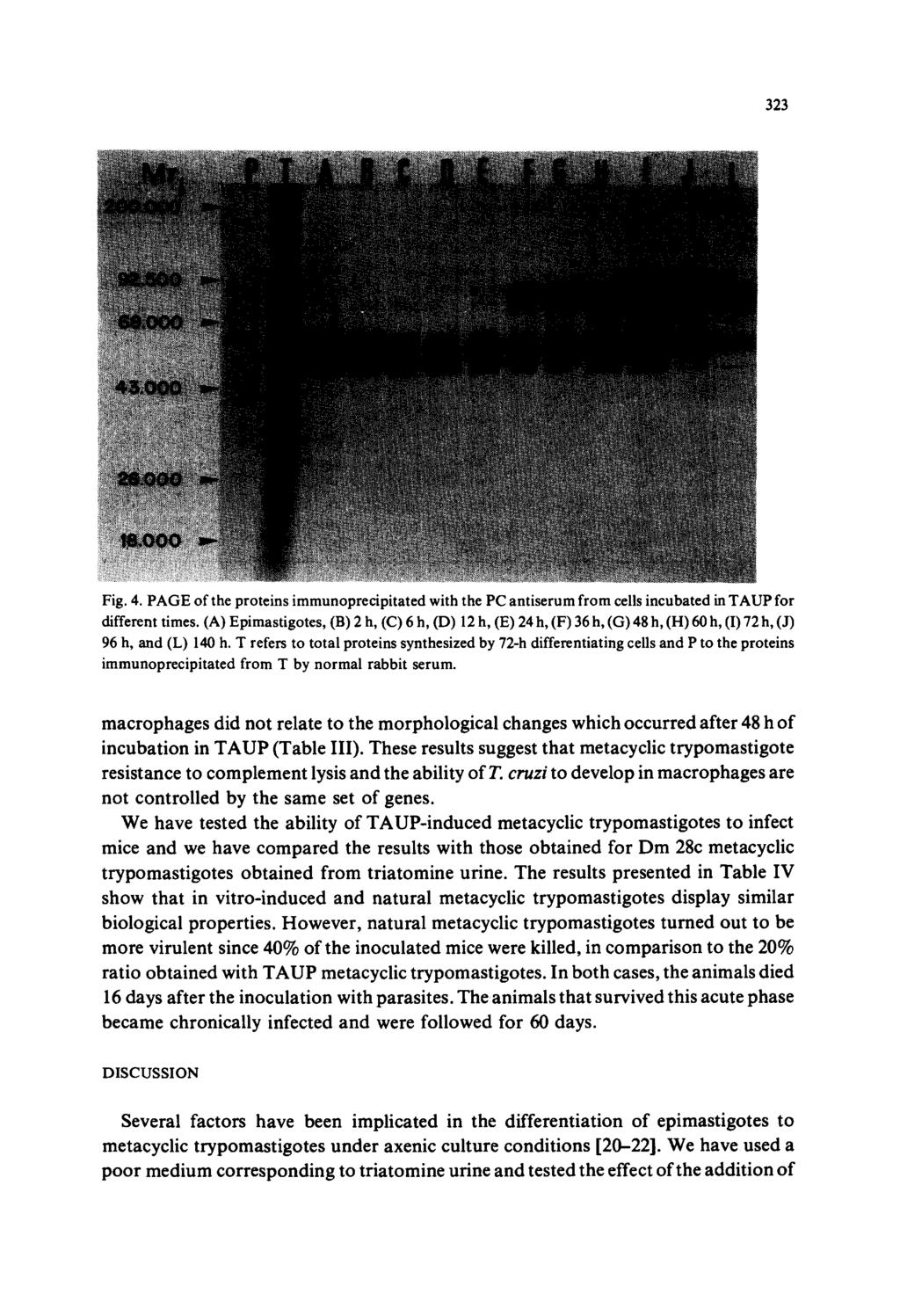 323 Fig. 4. PAGE of the proteins immunoprecipitated with the PC antiserum from cells incubated in TAUP for different times.