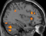 SPS and Empathy: Anterior Insula (AI) Activation R Seen for partner and stranger happy conditions 2 A. Activation of R Anterior Insula Brain Response (36,21,3) 1 0-1 -2 r =.62 p =.