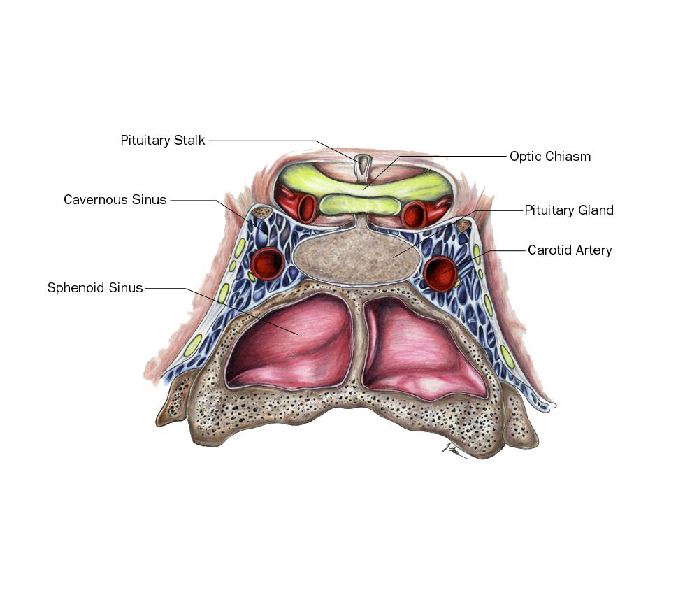 Reviewing the anatomy of the sellar region Depiction of sellar anatomy Companion patient 1: