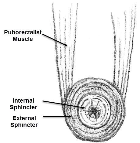 Causes There are many causes of ABL. They include: Injury or weakness of the sphincter muscles. Injury or weakening of one of both of the sphincter muscles is the most common cause of ABL.