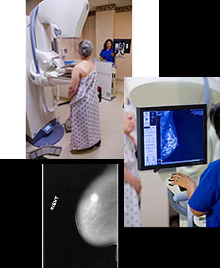 A mammogram is an x-ray of the breast.