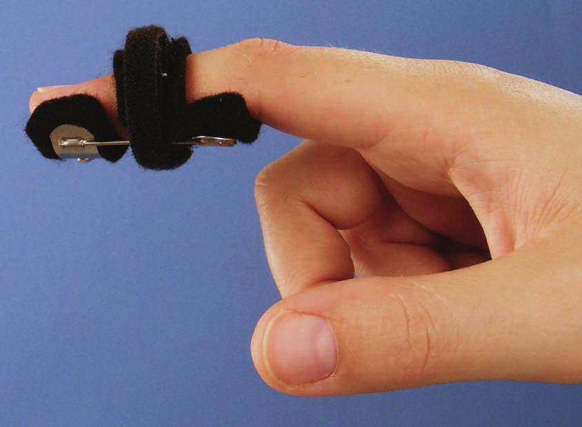 #6MINI Mini Safety Pin Splint to extend DIP Joint.