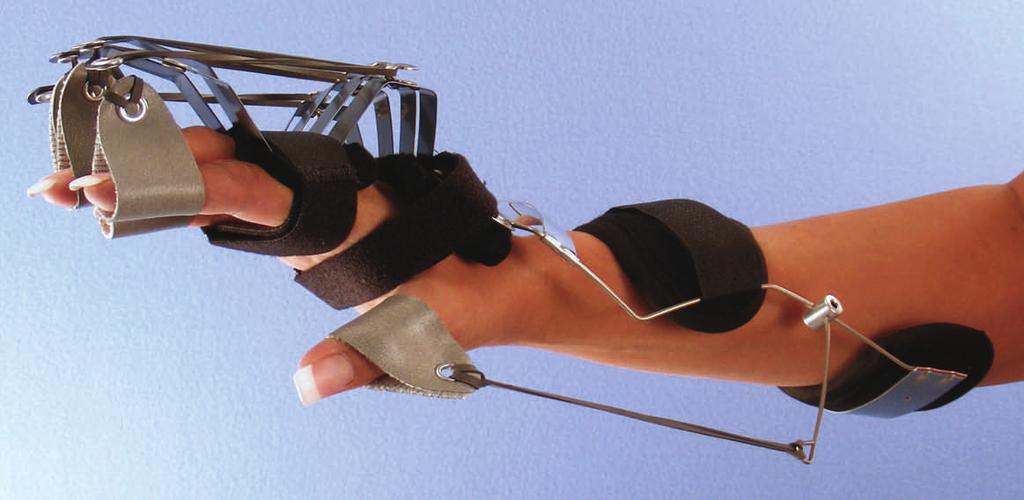 1 Combination of Spring Wire Oppenheimer with Reverse Knuckle Bender to extend the metacarpophalangeal joints and outrigger to extend distal