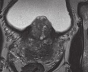 prostate MR imaging one of radiology