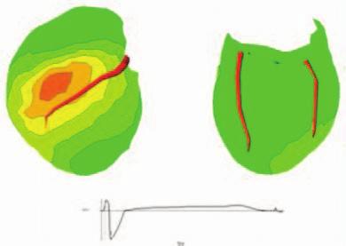 Electrical Mapping of Canine Ventricles
