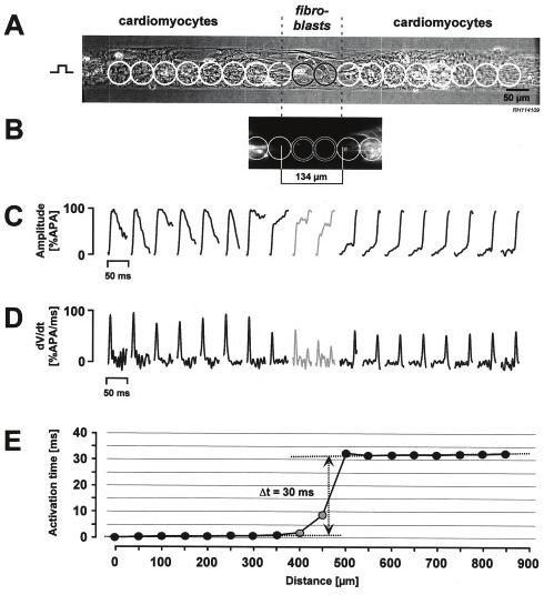 Experimental Studies of Conduction in Cell Culture Myocyte strand with fibroblast insert