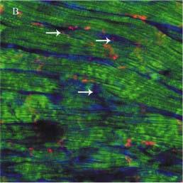 Fibroblast Organization in Rat Neonatal Myocardium Discoidin domain receptor (DDR) - Fibroblasts Actin - Myocytes Cx43 -