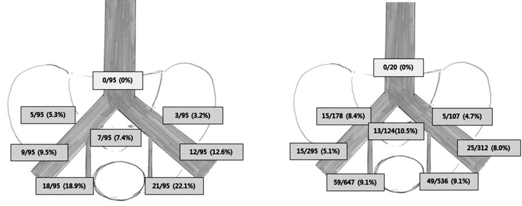Sang Eun Lee, et al:comparision between Standard and Extended Pelvic Lymph Node Dissections During Radical Cystectomy 12