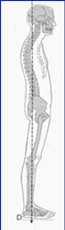 vertebral fractures Exercise and therapeutic