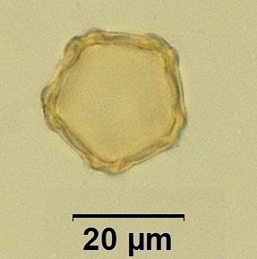 4 5 Pollen grains of Duschekia